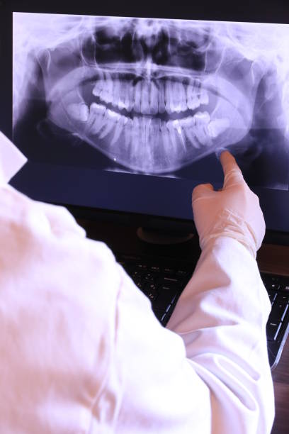 Best Emergency Dental Care for Broken or Chipped Teeth in Pleasure Point, CA